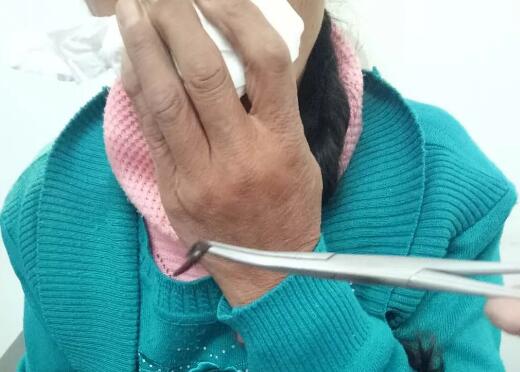 雞皮疙瘩掉一地，鼻子出螞蟥就在你身邊，你還敢喝生水嗎？