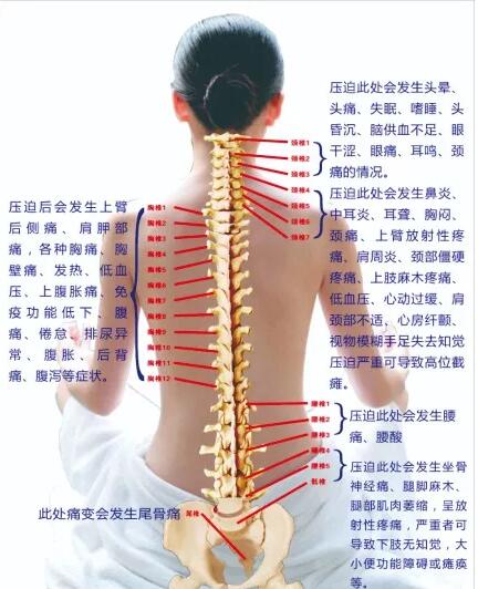 保護(hù)腰椎—示范腰椎保健操，趕快收藏吧