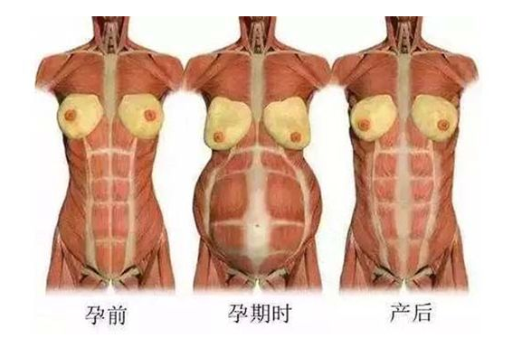 產(chǎn)后媽媽骨盆修復――帶你回到完美身材！