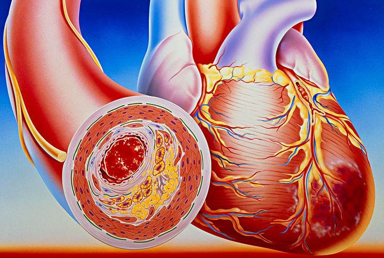 看清心臟動(dòng)脈，判斷病癥，及早治療冠心?。?></a></div>
               
 					<div   id=