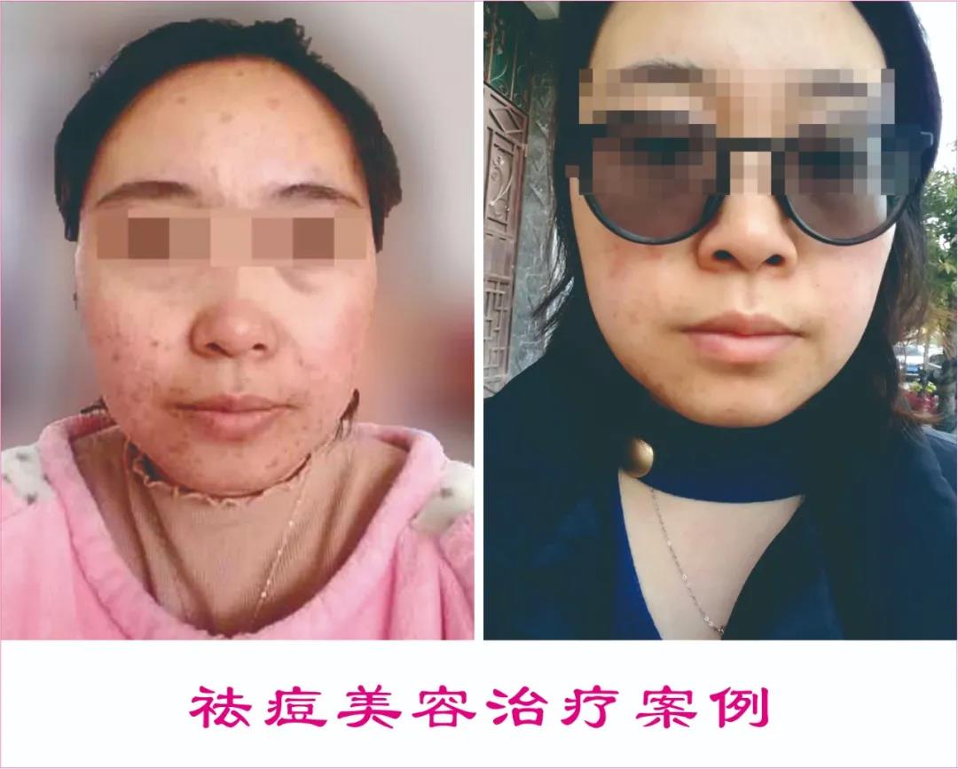 中醫(yī)駐顏，標本兼治|中醫(yī)養(yǎng)生駐顏保健治療中心