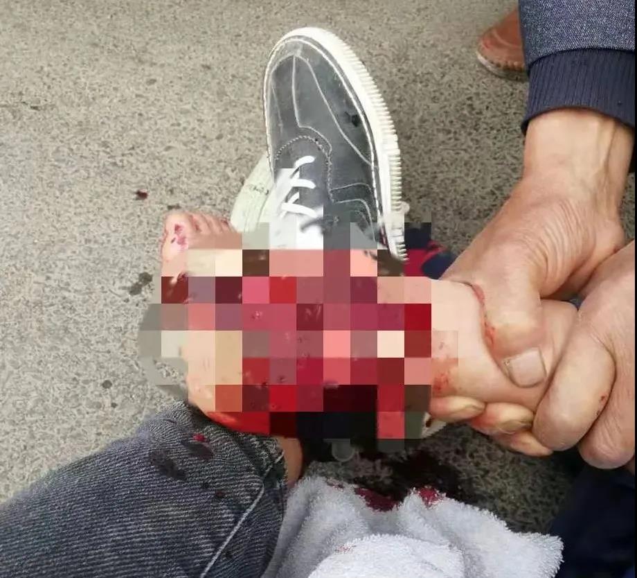 【保山安利醫(yī)院】創(chuàng)傷急救到處跑，不如安利把醫(yī)找！