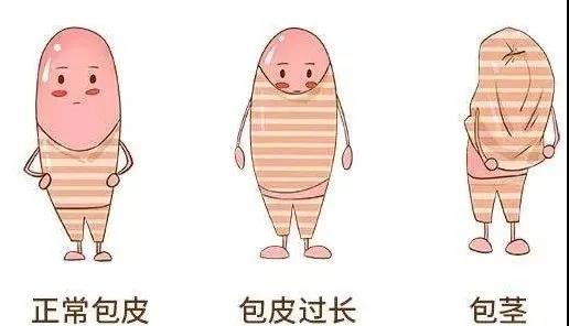 【保山安利醫(yī)院】家長(zhǎng)速看！暑期包皮手術(shù)預(yù)約正當(dāng)時(shí)！