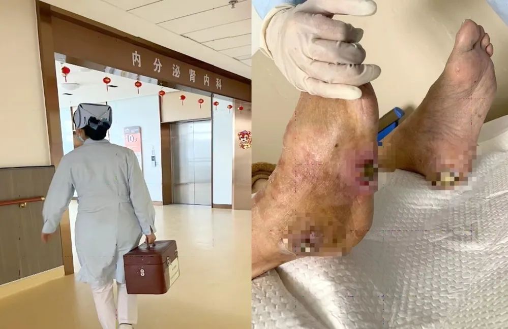 【保山安利醫(yī)院】傷口治療一站式，健康生活零距離！